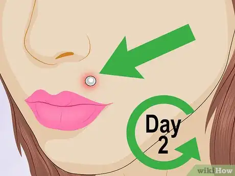 Image intitulée Tell if a Piercing Is Infected Step 1