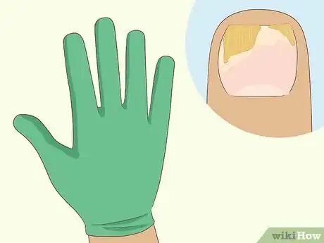 Image intitulée Heal Damaged Nails Step 4