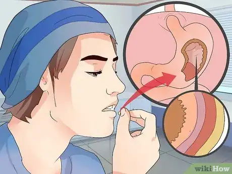 Image intitulée Take Glutamine Step 10