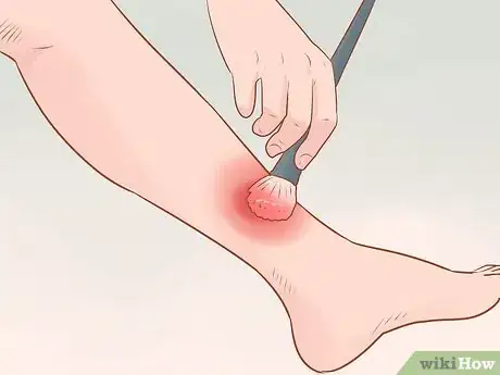 Image intitulée Fake an Injury Step 27