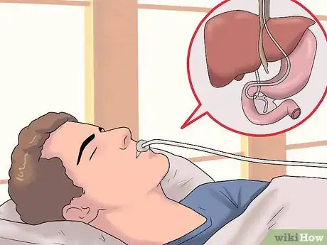 Image intitulée Know if You Have an Enlarged Liver Step 13