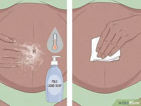 Image intitulée Manage Belly Button Rings During Pregnancy Step 5