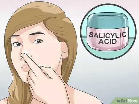 Image intitulée Get Rid of Acne on Your Nose Step 2