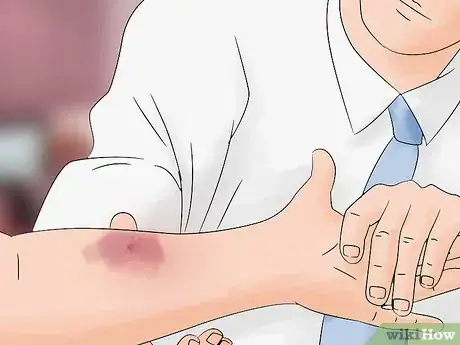 Image intitulée Identify a Black Widow Spider Step 14
