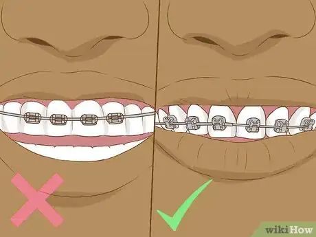 Image intitulée Make Fake Braces or a Fake Retainer Step 18