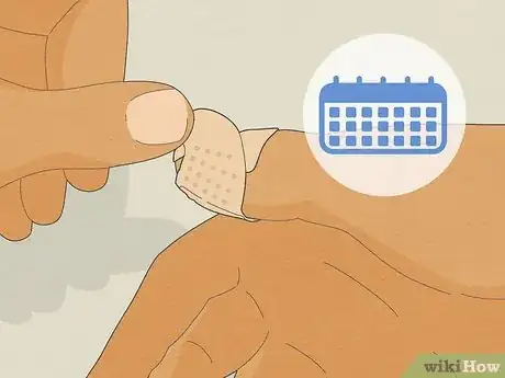 Image intitulée Stop Biting Your Nails Step 25