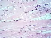 Muscle tissue, cell nuclei (blue-purple), extracellular material (pink).