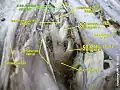 Iliolumbar artery