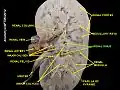 Renal sinus