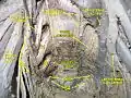Pelvic contents: male.Superior view.Deep dissection.