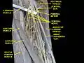 Great saphenous vein. Deep dissection. Anterior view.