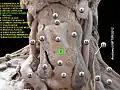 Cricothyroid ligament