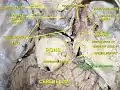 Vestibulocochlear nerve