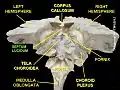 Septum pellucidum (labelled "septum lucidum") seen in a specimen from a cadaver.