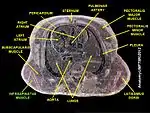 Infraspinatus muscle