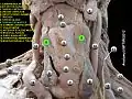 Thyrohyoid muscle