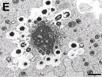 Electron micrograph of virus factory in an amoeba co-infected with Zamilon and Mont1 (scale bar: 0.1 μm)