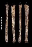 A tibia