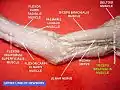 Triceps brachii muscle (of a newborn)