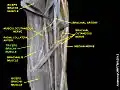 Triceps brachii muscle (shown in green text)