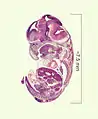 Histological film 10-day mouse embryo