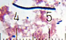 "Lactobacillus delbrueckii" subsp. "bulgaricus" from a sample of . Numbered ticks are 10 μm apart.