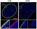 Comparison confocal microscopy – 3D-SIM