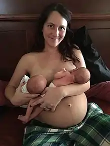 Woman nurses twins six days after birth. The linea nigra is still visible.