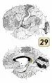 Brodmann area 29