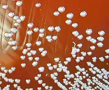 "Burkholderia pseudomallei" colonies on a blood agar plate