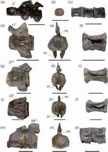 Gray vertebrae seen from different angles