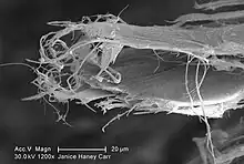 Scanning electron microscopy of white asbestos with needle-like shape fibre