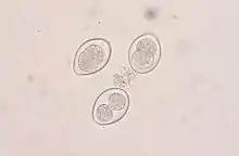 Coccidia oocysts in a fecal flotation from a cat. The cat was underweight and had diarrhea, showing signs of coccidiosis.