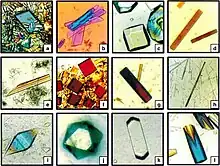 Protein crystals grown by American scientists on the Russian Space Station Mir in 1995.