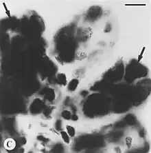 Black and white Feulgen stained microphotograph depicting intact tick salivary glands infected by deer tick virus. Hypotrophied salivary acinus filled with amorphous masses of pinkstaining (=Feulgen positive) material (arrows). Scale bar = 10 µm.