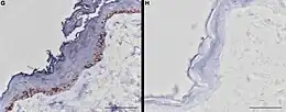 Skin biopsies stained blue. The one at left, from a non-white horse, shows much more blue staining and contains a layer of melanocytes. The melanocytes can be identified by the presence of brown pigment granules.