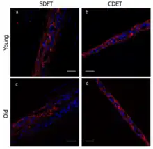 Organization of elastin in equine tendons. With increasing age, there is a decrease in elastin content.