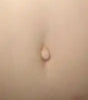 An outie navel