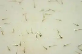 Within days, the vulnerable goldfish eggs hatch into larvae, and rapidly develop into fry