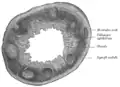 Transverse section of human vermiform process. X 20.