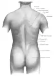 Surface anatomy of the back. (Label for Teres major at upper right.)