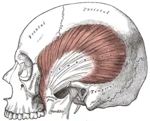 The temporalis; the zygomatic arch and masseter have been removed.