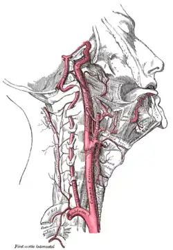 The internal carotid and vertebral arteries, right side