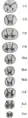 Cross-sections of the spinal cord at varying levels