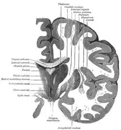 Coronal section of brain through intermediate mass of third ventricle.