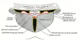 Coronal section of lateral and third ventricles.