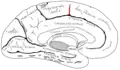 Paracentral sulcus. It defines the anterior boundary of the paracentral lobule.