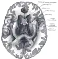 The fornix and corpus callosum from below.