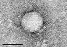 Electron micrograph of Hepacivirus C purified from cell culture. Scale bar& = 50 nanometres