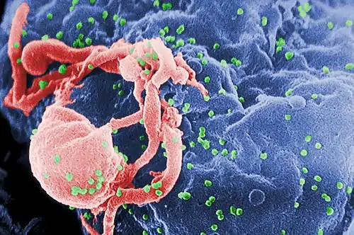 Scanning electron micrograph of HIV-1 (in green) budding from cultured lymphocyte. Multiple round bumps on cell surface represent sites of assembly and budding of virions.